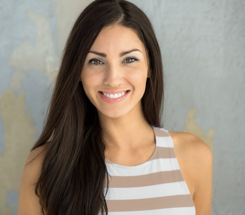 girl after getting botox in coral gables